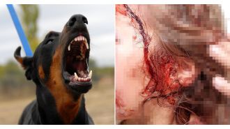 Young girl hurt badly in attack by family pet