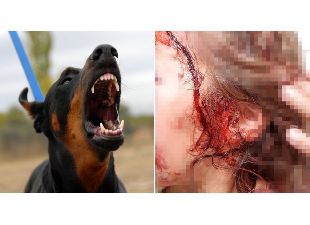 Young girl hurt badly in attack by family pet