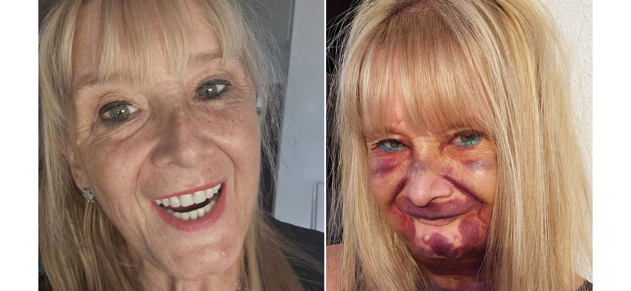 Grandmother spends a lot of money on new set of dentures and is very happy with the results.
