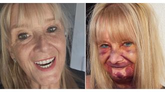 Grandmother spends a lot of money on new set of dentures and is very happy with the results.