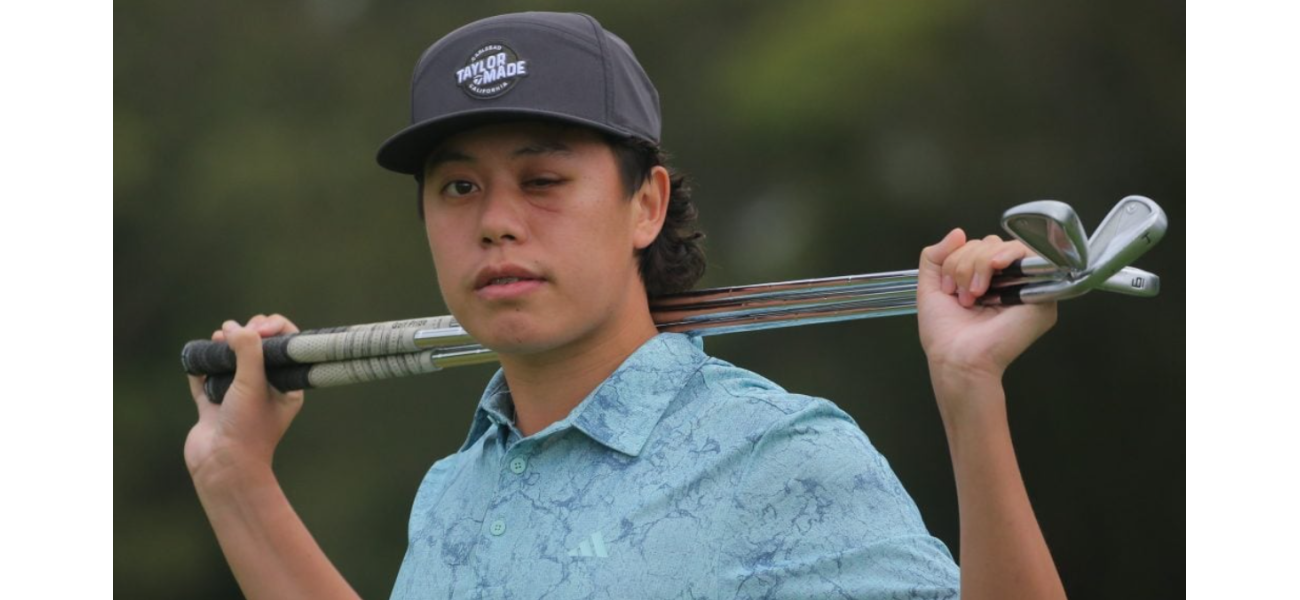 Young golfer committed to pursuing career despite losing vision in one eye due to unexpected accident.