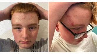 A 14-year-old autistic boy was attacked by a group of teenagers who stabbed him in the head and attempted to set him on fire.