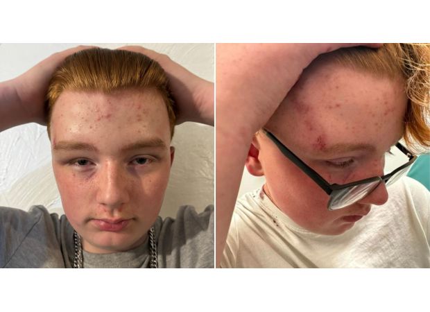 A 14-year-old autistic boy was attacked by a group of teenagers who stabbed him in the head and attempted to set him on fire.