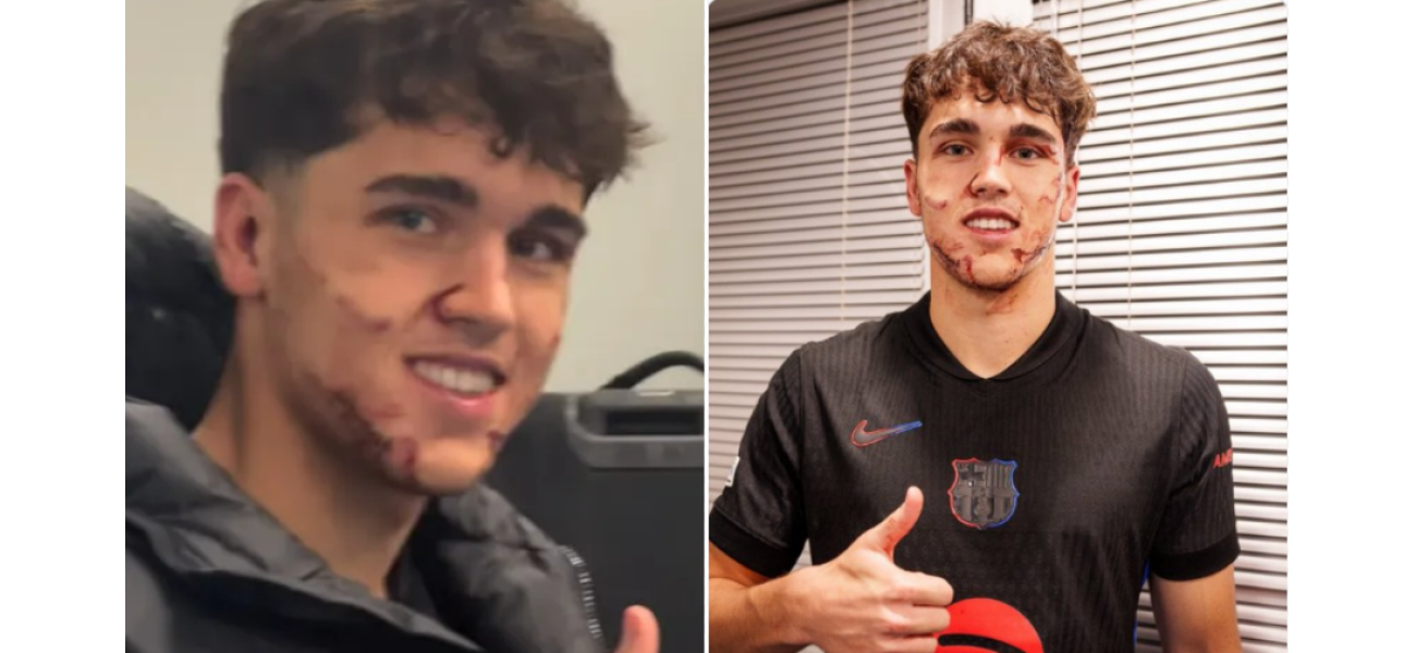 Injured Barcelona player suffers brutal facial injuries after being kicked during match.