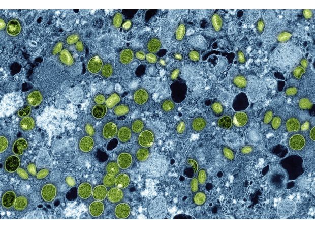 UK has found four people with new lethal mpox variant.