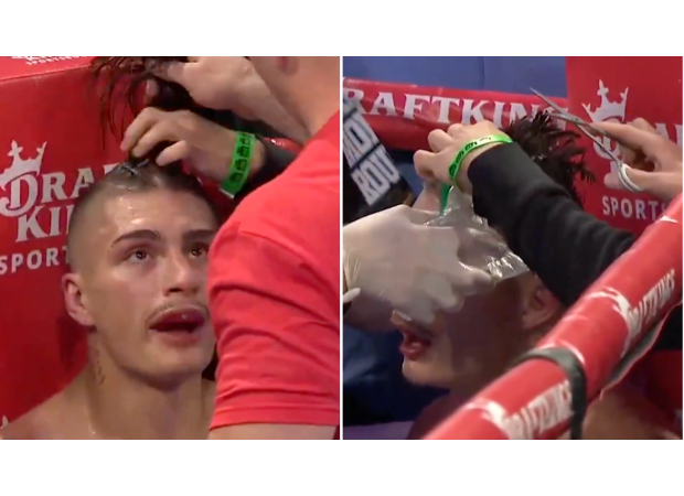 Boxer receives surprise grooming during match when he is forced to get a haircut.