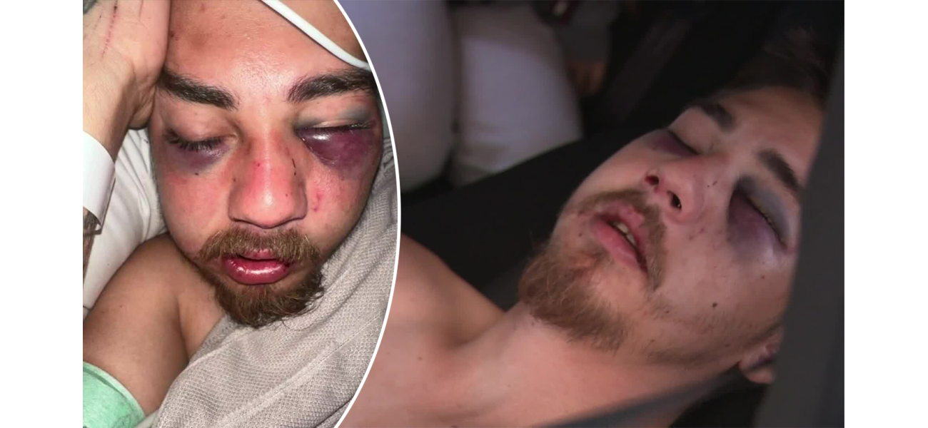 A father in Perth was severely injured after being attacked during a night out, leaving his face badly damaged.