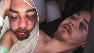 A father in Perth was severely injured after being attacked during a night out, leaving his face badly damaged.