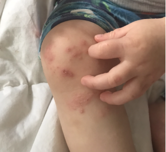 Doctor seeks to revolutionize approach to diseases that negatively impact large numbers of people.