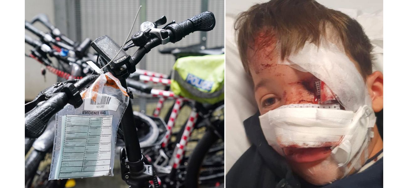 A 10-year-old boy suffered a severe injury to his nose when he was struck by an e-bike rider.