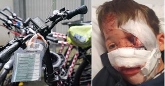 A 10-year-old boy suffered a severe injury to his nose when he was struck by an e-bike rider.
