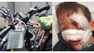 A 10-year-old boy suffered a severe injury to his nose when he was struck by an e-bike rider.