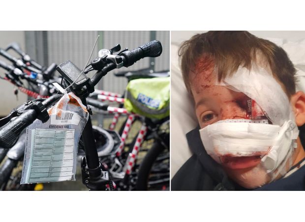 A 10-year-old boy suffered a severe injury to his nose when he was struck by an e-bike rider.
