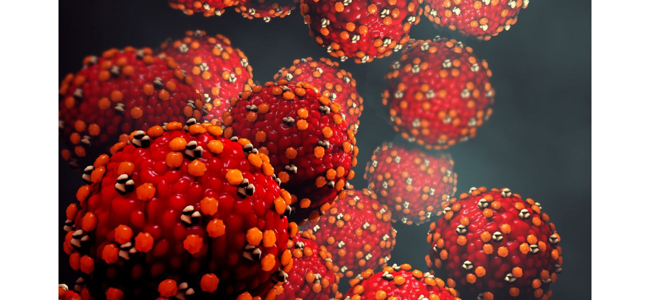 Warning issued after person with measles visited gas station, brewery, and doctor's office.