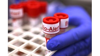 New form of mpox discovered in San Mateo County, first case in the U.S.