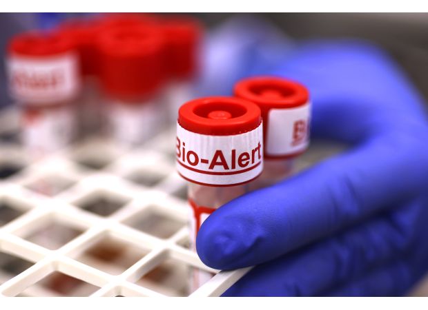 New form of mpox discovered in San Mateo County, first case in the U.S.