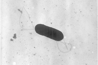 One infant died and nine people were hospitalized due to a Listeria outbreak in four states.