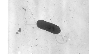 One infant died and nine people were hospitalized due to a Listeria outbreak in four states.