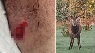 Man attacked by stag with antlers in seemingly endless encounter.