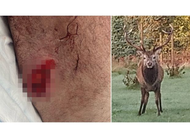 Man attacked by stag with antlers in seemingly endless encounter.