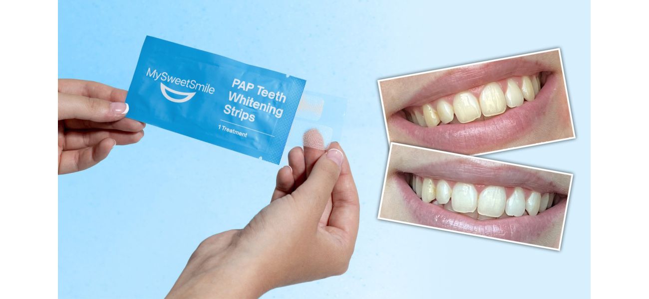 I used fast-acting whitening strips and saw great results in 30 minutes - now on sale for 25% off!