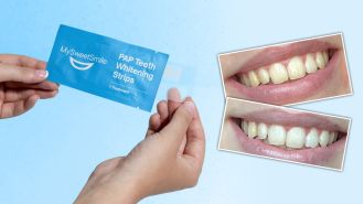 I used fast-acting whitening strips and saw great results in 30 minutes - now on sale for 25% off!