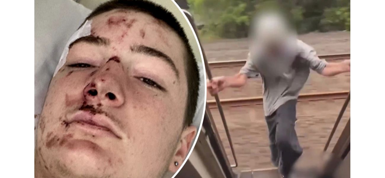 A teen warns about the danger of a social media trend after breaking their legs and being covered in blood.