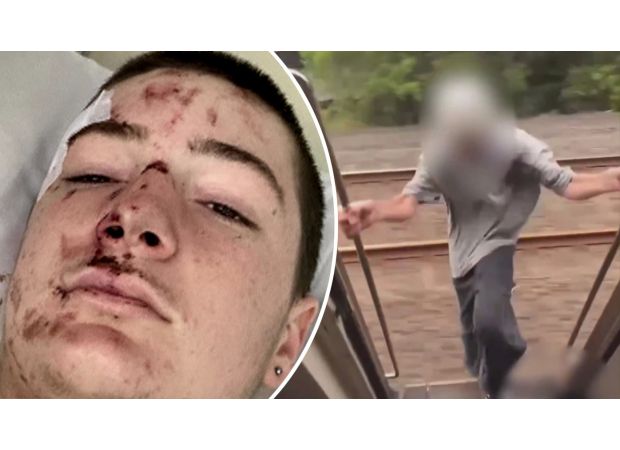 A teen warns about the danger of a social media trend after breaking their legs and being covered in blood.