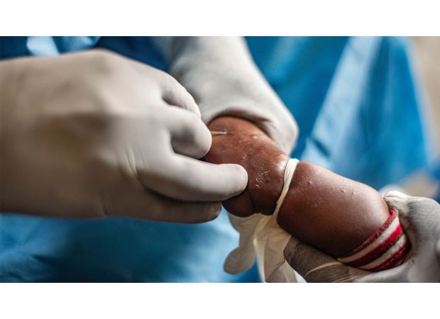 Specialists venture into the rainforest to identify unknown disease that has resulted in 143 deaths.