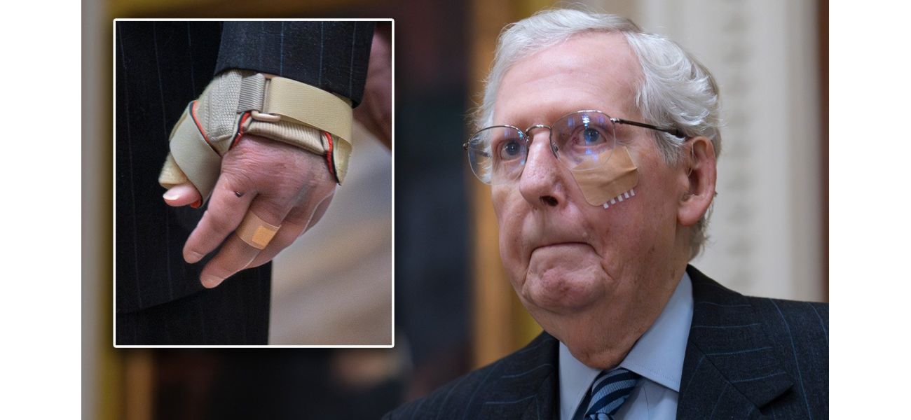 Lawmaker injures himself at luncheon, spraining and cutting his body.