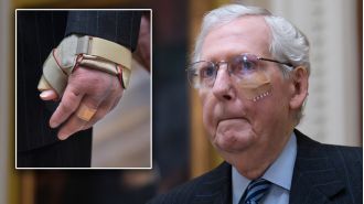 Lawmaker injures himself at luncheon, spraining and cutting his body.