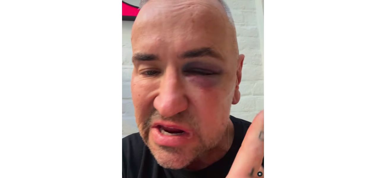 DJ Fat Tony suffered injuries after an alleged attack at a gig and was taken to the hospital.