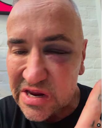 DJ Fat Tony suffered injuries after an alleged attack at a gig and was taken to the hospital.