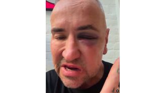 DJ Fat Tony suffered injuries after an alleged attack at a gig and was taken to the hospital.