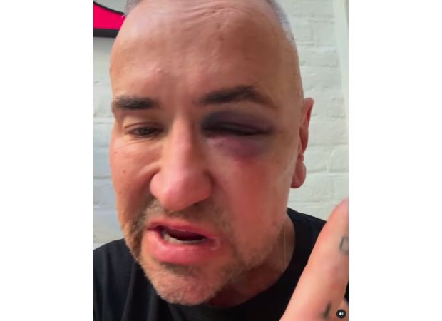 DJ Fat Tony suffered injuries after an alleged attack at a gig and was taken to the hospital.