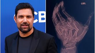 The actor from The Hobbit suffers severe injuries in a scary dune buggy accident.