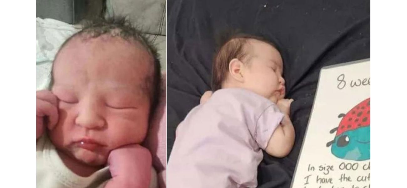 A baby named Antonia's skull was broken in during a suspected violent burglary.