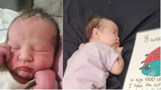 A baby named Antonia's skull was broken in during a suspected violent burglary.