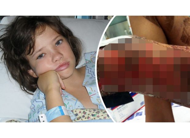 We have limited knowledge about the creature that nearly killed Rachael.