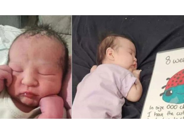 A baby named Antonia's skull was broken in during a suspected violent burglary.