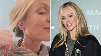 Fearne Cotton bravely displays post-surgery scars, embracing them as a symbol of strength and courage.