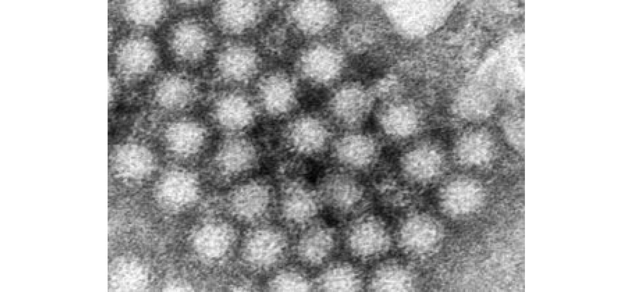 CDC data reveals increase in norovirus cases in certain areas of the US.