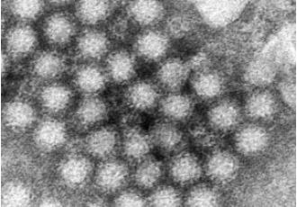 CDC data reveals increase in norovirus cases in certain areas of the US.