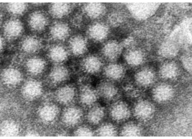 CDC data reveals increase in norovirus cases in certain areas of the US.