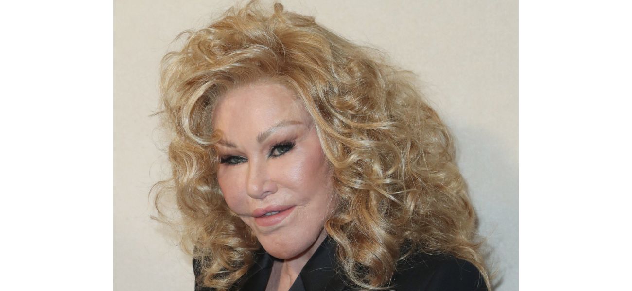 Catwoman Jocelyn Wildenstein, famous for her extreme cosmetic procedures, passes away at 84.