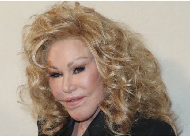 Catwoman Jocelyn Wildenstein, famous for her extreme cosmetic procedures, passes away at 84.