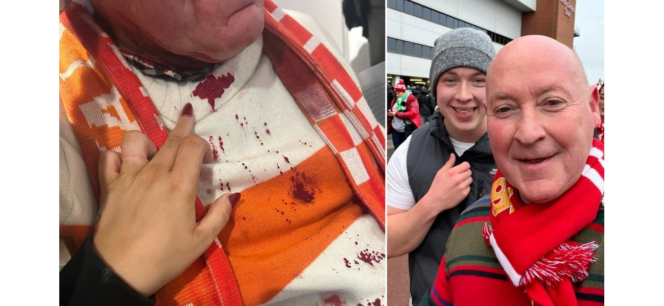 Liverpool supporter sustains severe head wound in violent assault by opposing team fan.