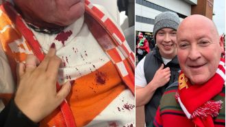 Liverpool supporter sustains severe head wound in violent assault by opposing team fan.