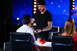 British talent show contestant reveals he has lost 60% of his cornea due to burns.