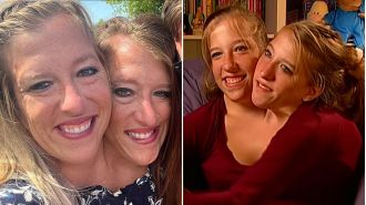 Conjoined twins reveal truth about their physical connection.